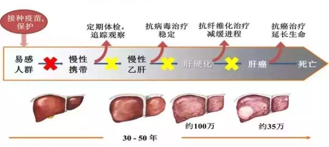 甲肝治疗的时间长度，深入了解与应对