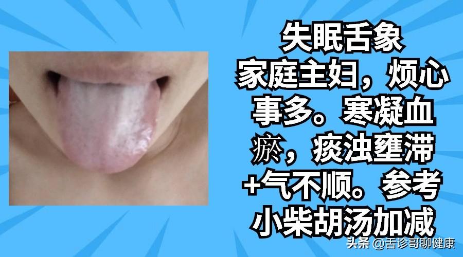 两个月宝宝舌苔，观察、理解与照顾